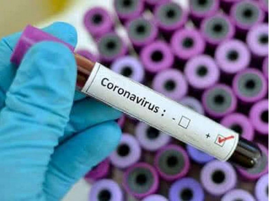 В Киево-Печерской Лавре обнаружили новые случаи COVID-19