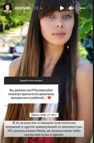 Никакой пластики: Анна Неплях показала, как выглядела в 17 лет