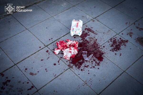 Оккупанты ударили баллистикой по Одессе: пострадали 29 человек, четверо погибли (обновляется)