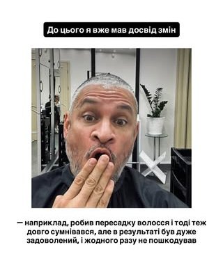 Ектор ліг під ніж хірурга: суддя &laquo;МайстерШефа&raquo; пояснив, чому зважився на&nbsp;пластику обличчя