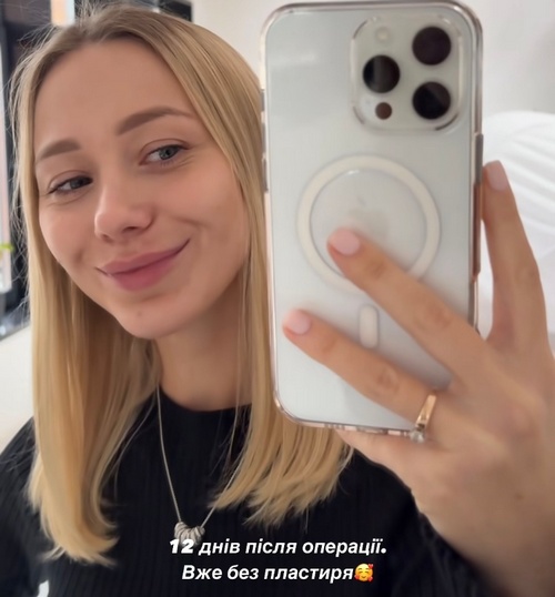 Дружина Віктора Павліка показала обличчя після пластики